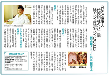 たばこと病気（1）代表的なタバコ病　肺ガン、喉頭ガン、COPD